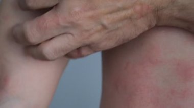 Kovan derisini ellerimle kaşıyorum. 