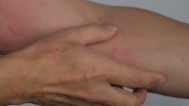 Kovan derisini ellerimle kaşıyorum. 