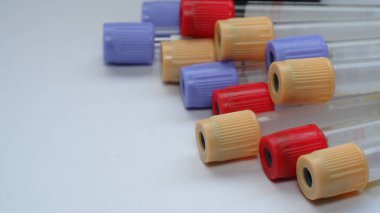 Çok renkli boş kan tüpü testi.