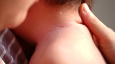 Residual powder and white lotion on the newborn baby's neck. clipart