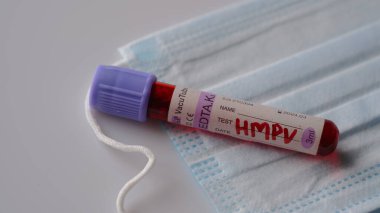 İnsan metafnömotorirüsü veya HMPV kan testi tüpü, yaygın bir soğuk algınlığının yol açtığına benzer hafif enfeksiyonlara neden olan bir solunum virüsüdür..
