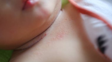 Bebeğin boynunda şiddetli bir sıcak var..