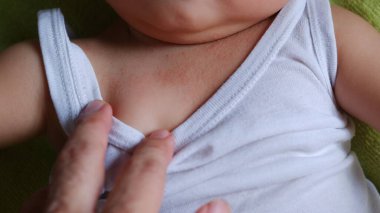 Bebeğin boynunda şiddetli bir sıcak var..