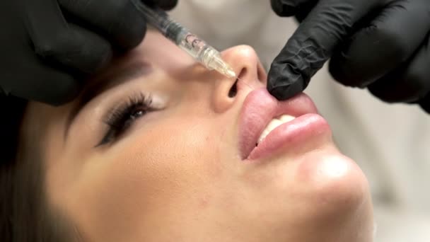 女性唇 外科医生戴着医用手套 用注射器小心而缓慢地将透明质酸注入妇女的嘴唇 扩大唇的程序 注射美容品整形手术 — 图库视频影像