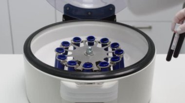 Cosmetologist extracting blood plasma using a centrifuge. The doctor takes out tubes with blood plasma.