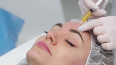 Top view medium close-up shot of platelet rich plasma face injections procedure | PRP Therapy in beauty salon | Young brown-haired female Caucasian patient.