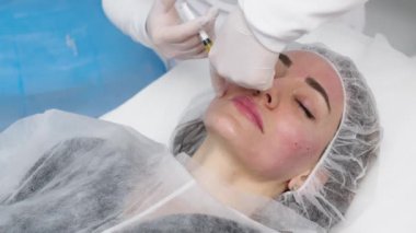 Top view medium close-up shot of platelet rich plasma face injections procedure | PRP Therapy in beauty salon | Young brown-haired female Caucasian patient.