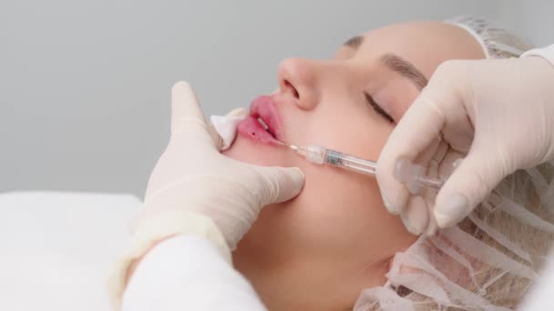 Close Female Lips Surgeon Medical Gloves Carefully Slowly Injects Hyaluronic — Stok video