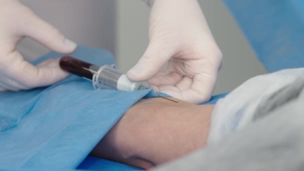 Laboratóriumi Dolgozó Orvos Vesz Egy Vérmintát Elemzésre Kéz Közelről Vérvétel — Stock videók