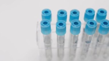 Beyaz laboratuvar arka planında test tüpüne dökülen sıvının yakın görüntüsü