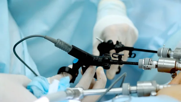 Operationssaal Team Von Chirurgen Die Laparoskopische Eingriffe Durchführen Moderne Medizin — Stockfoto