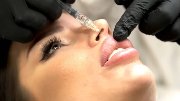 A cosmetologist makes multiple injections of biorevitalization with hyaluronic acid into the skin of a woman\'s face on the chin under the lips, close-up. Young woman on mesotherapy procedure in beauty