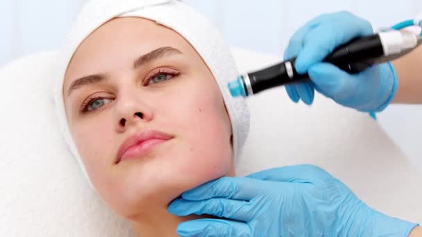 Cuidado Piel Facial Primer Plano Mujer Consiguiendo Tratamiento Facial Microdermoabrasión — Vídeo de stock