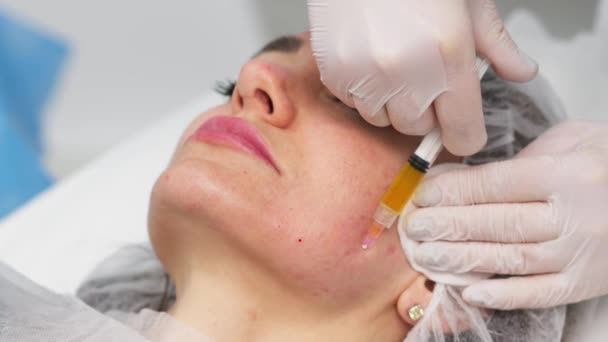 Kobieta Robiąca Terapię Botulinową Nowoczesnej Klinice Kosmetologicznej Profesjonalny Kosmetolog Wykonujący — Wideo stockowe