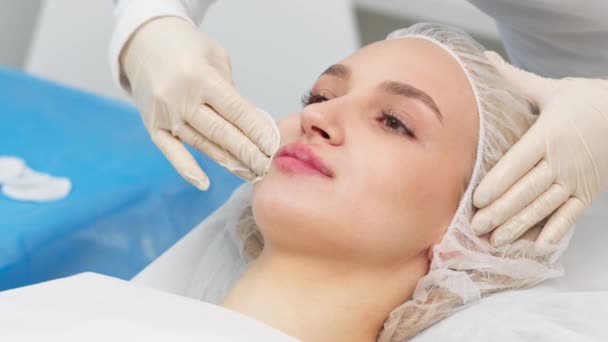 Surgeon Medical Gloves Carefully Slowly Injects Hyaluronic Acid Woman Lips — Stock Video