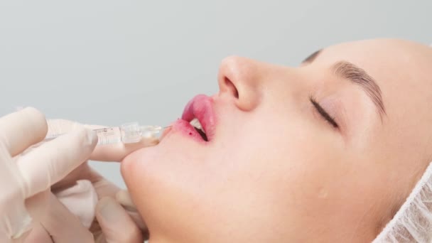 Close Female Lips Surgeon Medical Gloves Carefully Slowly Injects Hyaluronic — Stock Video