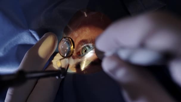 Mikroskop Ile Görüş Düzeltmesi Eldivenli Cerrahın Elleri Lazer Görüş Düzeltmesi — Stok video