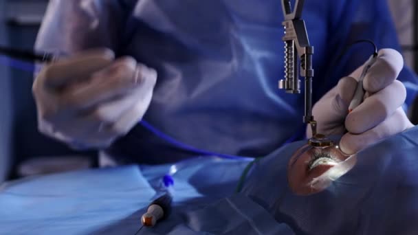 Διόρθωση Όρασης Μικροσκόπιο Χειρουργός Χέρια Γάντια Που Εκτελούν Διόρθωση Όρασης — Αρχείο Βίντεο