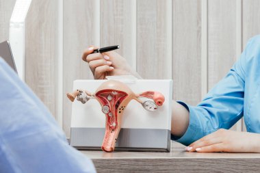 Bir jinekolog rahmin ve yumurtalıkların bir modelini tutuyor. Yumurtalık ve rahim kanseri, boyun rahatsızlığı, endometriyozis, histerektomi, rahim fibroidi, üreme sistemi ve hamilelik konsepti..