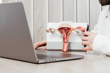 Bir jinekolog rahmin ve yumurtalıkların bir modelini tutuyor. Yumurtalık ve rahim kanseri, boyun rahatsızlığı, endometriyozis, histerektomi, rahim fibroidi, üreme sistemi ve hamilelik konsepti..