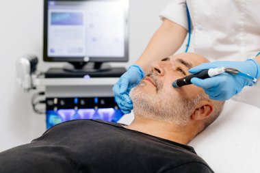 Erkek hasta modern bir güzellik kliniğinde su kaldırıcı yüz tedavisi görüyor. Bu işlemi profesyonel bir kozmetolog-dermatolog gerçekleştirerek, gelişmiş cilt bakımı ve yenilenmesini sağlar..