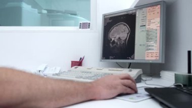 Radyoloji uzmanı beyin taraması sonuçlarını monitörde incelerken hasta MRI ya da CT taramasından geçiyor. Gelişmiş tıbbi tanı ve ekipman göstermek için ideal.