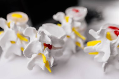 Modern klinikteki insan omurga plastik modellerine yakın çekim, sağlık ve tıp konsepti                         