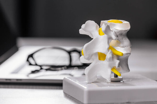 close-up view of human spine plastic models with laptop and eyeglasses on table in modern clinic, healthcare and medicine concept                         
