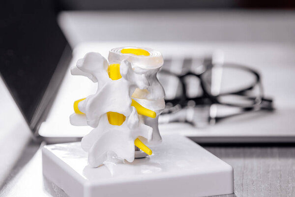 close-up view of human spine plastic models with laptop and eyeglasses on table in modern clinic, healthcare and medicine concept                         