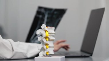 İnsan kemiklerinin yakın plan görüntüsü plastik model ve dizüstü bilgisayar ve MRI taramalarıyla çalışan doktor modern klinik, sağlık ve tıp konseptiyle sonuçlandı               