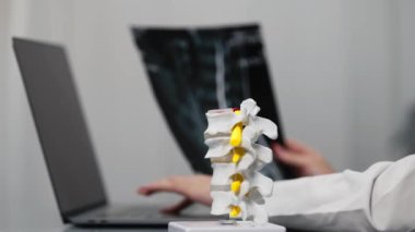 İnsan kemiklerinin yakın plan görüntüsü plastik model ve dizüstü bilgisayar ve MRI taramalarıyla çalışan doktor modern klinik, sağlık ve tıp konseptiyle sonuçlandı               