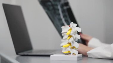 İnsan kemiklerinin yakın plan görüntüsü plastik model ve dizüstü bilgisayar ve MRI taramalarıyla çalışan doktor modern klinik, sağlık ve tıp konseptiyle sonuçlandı               