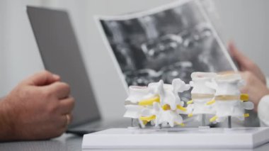 Doktor röntgenleri ve anatomik modelleri inceler. Dizüstü bilgisayardaki gözlemlere dikkat çeker. Detaylı tanı analizi ve hasta değerlendirmesi için ideal.