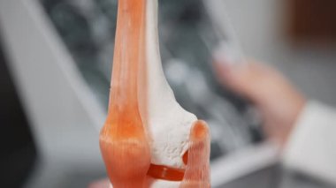 İnsan kemiklerinin yakın plan görüntüsü plastik model ve dizüstü bilgisayar ve MRI taramalarıyla çalışan doktor modern klinik, sağlık ve tıp konseptiyle sonuçlandı               