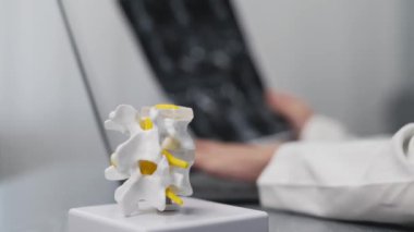 İnsan kemiklerinin yakın plan görüntüsü plastik model ve dizüstü bilgisayar ve MRI taramalarıyla çalışan doktor modern klinik, sağlık ve tıp konseptiyle sonuçlandı               