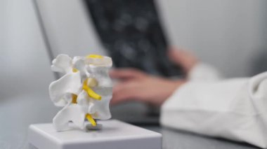 İnsan kemiklerinin yakın plan görüntüsü plastik model ve dizüstü bilgisayar ve MRI taramalarıyla çalışan doktor modern klinik, sağlık ve tıp konseptiyle sonuçlandı               