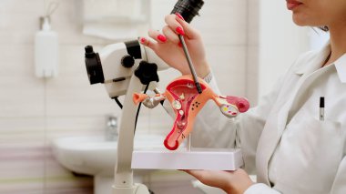 Jinekolog rahmin ve yumurtalıkların bir modelini tutuyor. Yumurtalık ve rahim kanseri, boyun rahatsızlığı, endometriyozis, histerektomi, rahim fibroidi, üreme sistemi ve hamilelik konsepti..