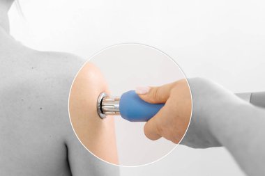 Fizyoterapist genç bir kadına şok dalgası terapisi uyguluyor. İyileşmeyi teşvik eden ve acıyı azaltan zararsız bir tedavi. Modern fizyoterapi tekniklerini ve tedavi yöntemlerini sergilemek için ideal..          