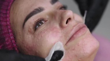 Klinikteki biyo-değerlendirmeden sonra kadın yüzü görüntüsünü kapat