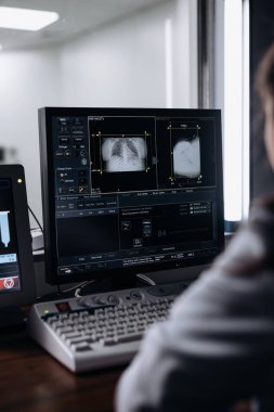 Kadın doktor hastanede röntgen cihazı kullanıyor.