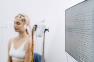 Elektrotları olan kadın denek, beyin aktivitesi verilerini ve tıbbi ekipmanları gösteren bir monitörle klinik bir ortamda beyin dalgası analizine katılıyor.