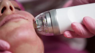 Yüz derisi tedavisinde kullanılan el bilgisayarı görüntüleniyor