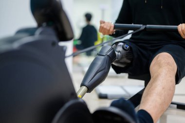 Spor salonunda protez bacakla egzersiz yapan engelli sporcu, protez imalatında yüksek teknolojili insanlar, engelliler için yeni yapay kol üretimi.