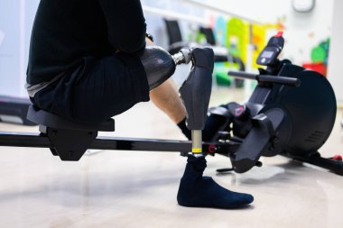 Fiziksel engelli hasta içeride egzersiz yapıyor, protez sağlık merkezinde yüksek teknolojili insanlar, engelliler için yeni yapay uzuv üretimi