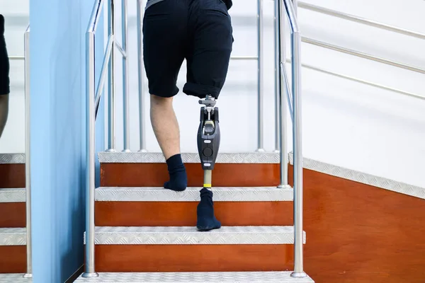Disabled athlete patient with physical disability doing exercise routine indoor, People with high tech technology at prosthetic health care center, New artificial limb production for disabled people