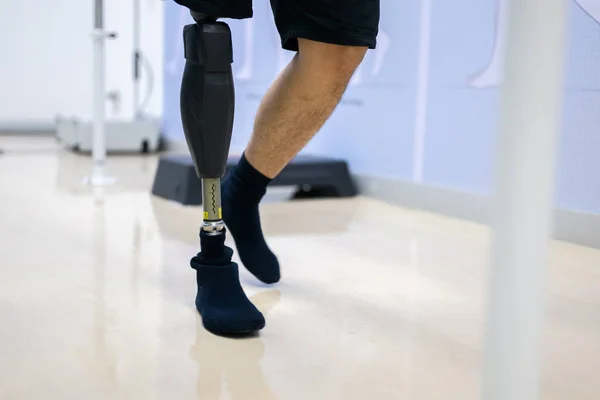 stock image Disabled athlete patient with physical disability doing exercise routine indoor, People with high tech technology at prosthetic health care center, New artificial limb production for disabled people