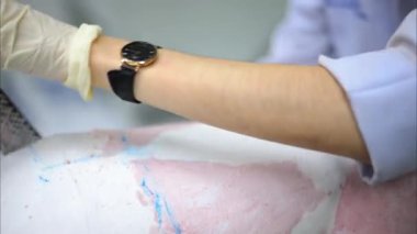 Protez üretim fabrikasında protez teknisyen alçı kalıbı, protez üretiminde yüksek teknoloji, engelliler için yeni yapay uzuv üretimi.