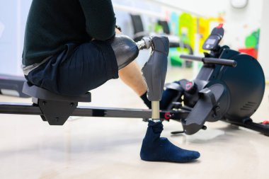 Fiziksel engelli hasta içeride egzersiz yapıyor, protez sağlık merkezinde yüksek teknolojili insanlar, engelliler için yeni yapay uzuv üretimi