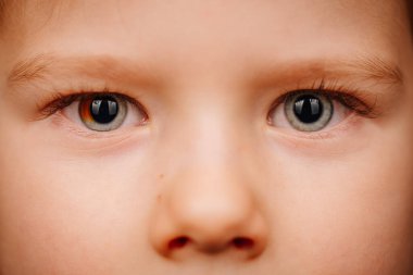 Valmiera, Letonya - 15 Kasım 2024 - Parlak, anlamlı gözleri ve doğal deri dokusuna odaklanan, masumiyet ve ayrıntıları vurgulayan bir çocuğun yüzüne yakın çekim