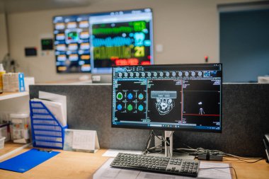 Valmiera, Letonya - 17 Ocak 2025 - Bilgisayarlı monitörde CT taraması sonuçlarını gösteren bir hastane çalışma istasyonu.